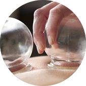 Cupping